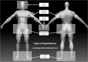 Types of Hyperhidrosis