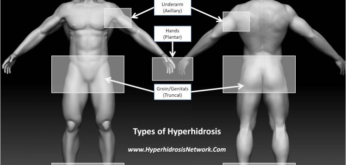 Types of Hyperhidrosis